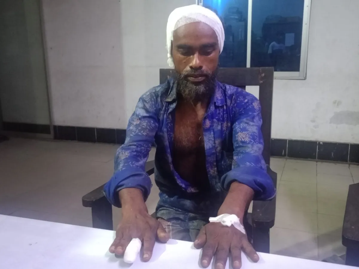 সোনারগাঁয়ে ঝালমুড়ির দাম চাওয়ায় বিক্রেতাকে পিটিয়ে আহত